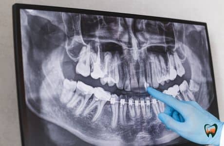 The Anatomy of Your Teeth