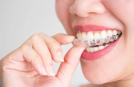 Straightening Your Smile with Invisalign