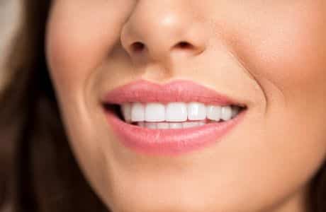Porcelain Veneers: The Secret to a Perfect Smile